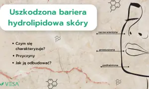 Uszkodzona bariera hydrolipidowa skóry objawia się zaczerwienieniem, przesuszeniem i podrażnieniem. Dowiedz się, jak ją odbudować.