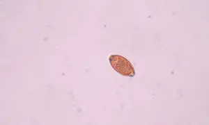Jajo pasożyta, prawdopodobnie włosogłówka, pod mikroskopem. Ma owalny kształt i brązową otoczkę.
