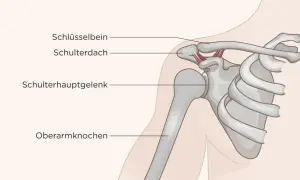 Anatomie der Schulter: Schlüsselbein, Schulterdach, Schulterhauptgelenk und Oberarmknochen. Mögliche Ursachen für Schulter Arm Syndrom.