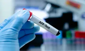 Badanie AFP - co to za badanie i dlaczego jest tak ważne?