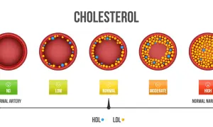 Jaki cholesterol jest dobry i jak poprawić jego poziom w organizmie
