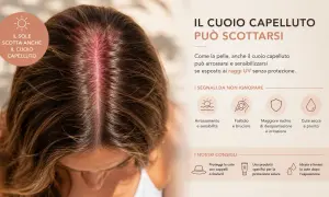 Cuoio capelluto arrossato dal sole, con indicazioni sui danni solari e consigli per la protezione.