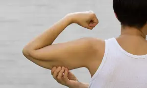 Braccio con pelle flaccida, segno di perdita tono muscolare cause.