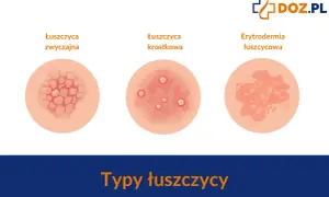 Ilustracje przedstawiają różne typy łuszczycy skóry: łuszczycę zwyczajną, krostkową i erytrodermię łuszczycową.