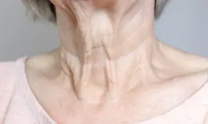 Primer plano del cuello de una mujer mayor, mostrando las arrugas del cuello y la piel con textura.