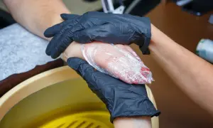 Dłonie w czarnych rękawiczkach owijają dłoń w folię, obok żółta wanna z płynem.