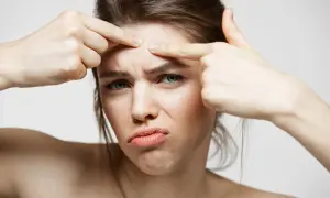 Kobieta z frustracją ogląda swoje czoło, być może zmagając się z trądzikiem neuropatycznym.
