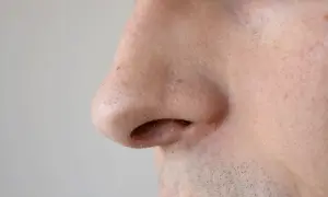 Primo piano del naso di un uomo, con pori dilatati visibili sulla pelle.