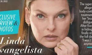 Kriolipoliza czy liposukcja kawitacyjna? Ekspert radzi!