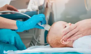 Lekarz wykonuje USG główki niemowlęcia, badając widoczny szew czołowy.