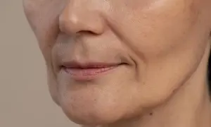 Primo piano del viso con pori dilatati visibili, texture della pelle e lievi rughe intorno alla bocca.