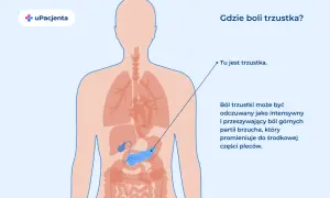 Ilustracja pokazuje lokalizację trzustki w ludzkim ciele. Ból trzustki może być objawem raka trzustki.