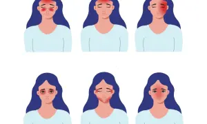Ilustracje przedstawiające nietypowe objawy migreny: ból głowy, oczu, twarzy i szyi.