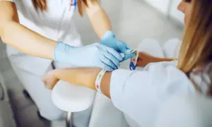 Pielęgniarka zakłada opaskę uciskową na ramię pacjentki przed pobraniem krwi. Czy progesteron trzeba robić na czczo? To pytanie, na które odpowiedź zależy od zaleceń lekarza.