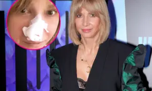 Grażyna Wolszczak po zabiegu. W okręgu zdjęcie z opatrunkiem na nosie, obok aktorka w eleganckiej kreacji.