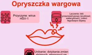 Jak zapobiec opryszczce? Odkryj sekrety trwałej odporności