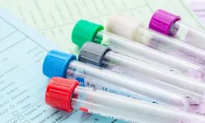 Kolorowe probówki na tle dokumentacji medycznej. Pokazują, ile ważne są badania krwi dla diagnostyki.