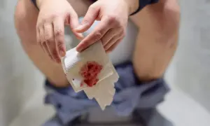 Krew utajona w kale: FIT czy gFOBT? Przygotuj się dobrze!