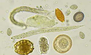 Microscopio muestra larvas y huevos de parásitos intestinales, como los que afectan a perros. Se observan gusanos y distintas formas de huevos.