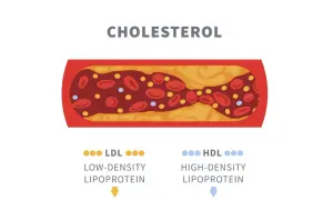 Schemat przedstawia przekrój naczynia krwionośnego z cholesterolem. Widać LDL (zły) i HDL (dobry), kluczowe dla lipidogramu normy.