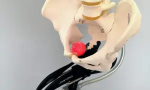 Modello anatomico del bacino su un supporto, con una sfera rossa posizionata per illustrare il dolore sellino bici.