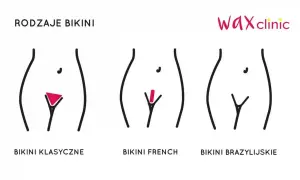 Ilustracja pokazuje rodzaje depilacji bikini: klasyczne, french i brazylijskie. Depilacja brazylijska efekty to gładkość.