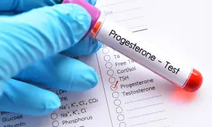 Rękawiczka trzyma probówkę z napisem "Progesteron - Test". Obok zaznaczono "Progesteron" na liście badań. Czy progesteron trzeba badać na czczo?