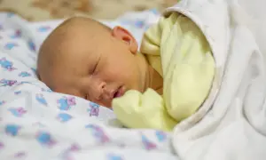 Bebé durmiendo con piel amarillenta, indicativo de bilirrubina alta en bebés.
