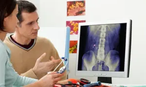 Medico e paziente esaminano una radiografia che mostra calcoli renali, possibile indicazione di malattia di Berger e potenziale invalidità.