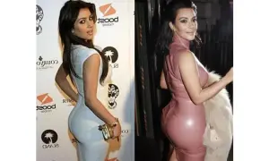 Kim Kardashian: Prawda o operacjach plastycznych i "efekcie BBL"