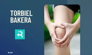 Najskuteczniejsze leki na torbiel Bakera - sprawdzone metody leczenia