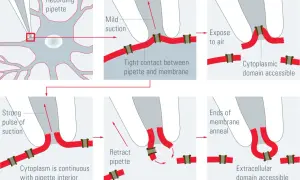Schema der Patch-Clamp-Technik: Zell-angeheftete, Ganzzell-, Inside-out- und Outside-out-Aufnahme.