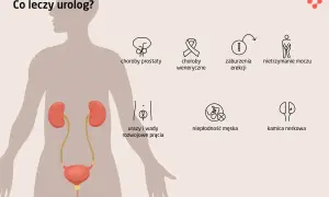 Intymny problem? Dermatolog czy urolog wybierz właściwie!