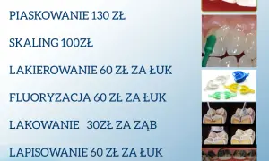 Ile kosztuje dorobienie zęba? Pełny cennik i jak wybrać mądrze.