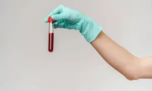Ręka w rękawiczce trzyma probówkę z krwią do analizy, w tym RDW-CV.