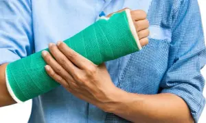 Złamana ręka – ile czasu trzeba nosić gips i co dalej?