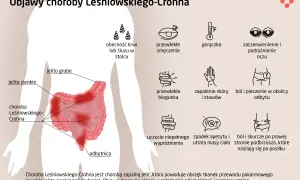 Choroba Leśniowskiego-Crohna: objawy obejmują zmęczenie, gorączkę, biegunkę, ból brzucha, problemy ze skórą i oczami.