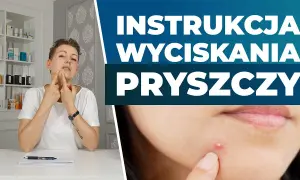 Wycisnęłaś pryszcza? Szybka pomoc, by uniknąć blizn i infekcji