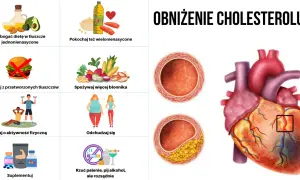 Jak obniżyć cholesterol w tydzień - proste sposoby na szybkie efekty