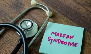 Stetoskop obok notatki z napisem "Marfan Syndrome". Informacja o chorobie, która może dotyczyć wielu układów.