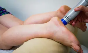 Behandlung eines Fußes mit einem Ultraschallgerät, um neurologische Ursachen für Krallenzehen zu lindern.
