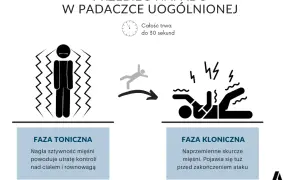 Padaczka: objawy, pierwsza pomoc i kluczowe informacje, które ratują życie