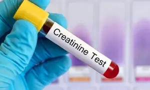 Kreatynina: przygotowanie do badania. Wyniki bez fałszu!