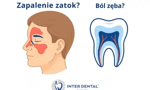 Zapalenie zatok czy ból zęba? Ilustracja pokazuje zatoki i ząb, sugerując, że ból podniebienia przy zębach górnych może być związany z zatokami.