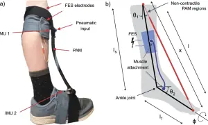 Sistema di elettrostimolazione per piede cadente con sensori IMU e attuatore PAM.
