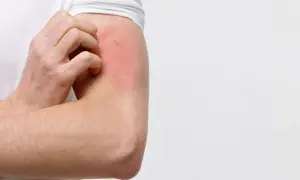 Juckende Haut am Arm, rot und gereizt. Was tun bei Hautjucken?