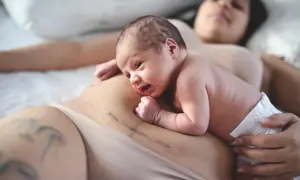 Nyfödd bebis på mammas mage med ärr efter kejsarsnitt. Hud mot hud-kontakt för att främja läkning och anknytning.