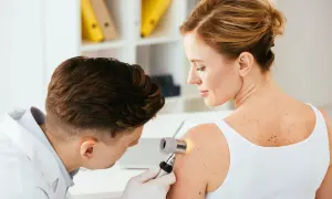 Dermatolog bada pieprzyk na ramieniu pacjentki. Warto pamiętać o samobadaniu skóry, by wcześnie wykryć czerniak na dziąśle lub innym miejscu.