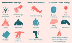 Danni ai nervi sensoriali, motori e autonomi, con sintomi come bruciore, intorpidimento, crampi, sudorazione eccessiva e problemi di equilibrio, possibili manifestazioni di neuropatia da stress.