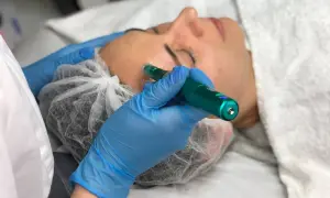 Zabieg dermapen. Kosmetolog w niebieskich rękawiczkach wykonuje mikronakłuwanie skóry twarzy. Pamiętaj o zaleceniach po zabiegu.
